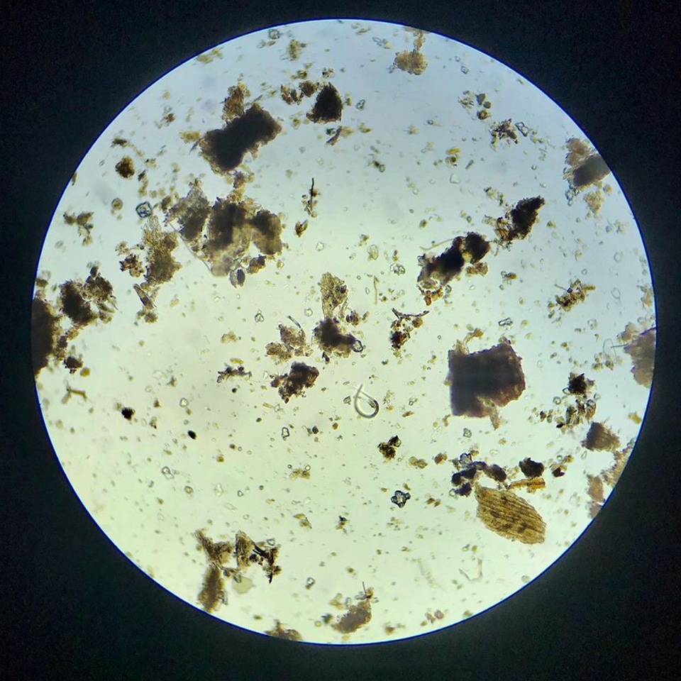 Microscopic view of soil microbes